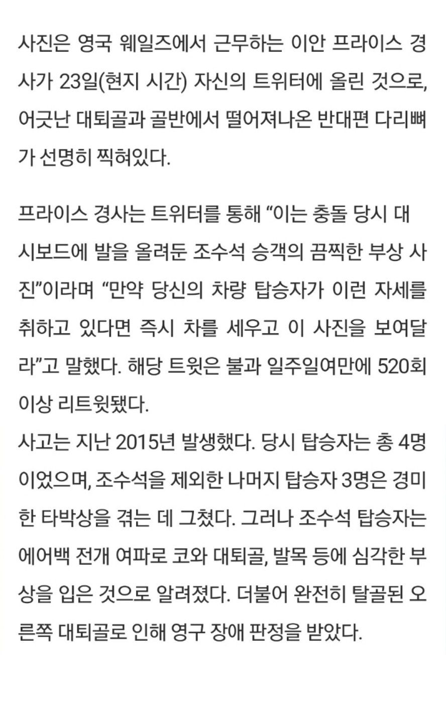 [유머] 대시보드에 발 올린채로 사고난 사람의 X-RAY -  와이드섬