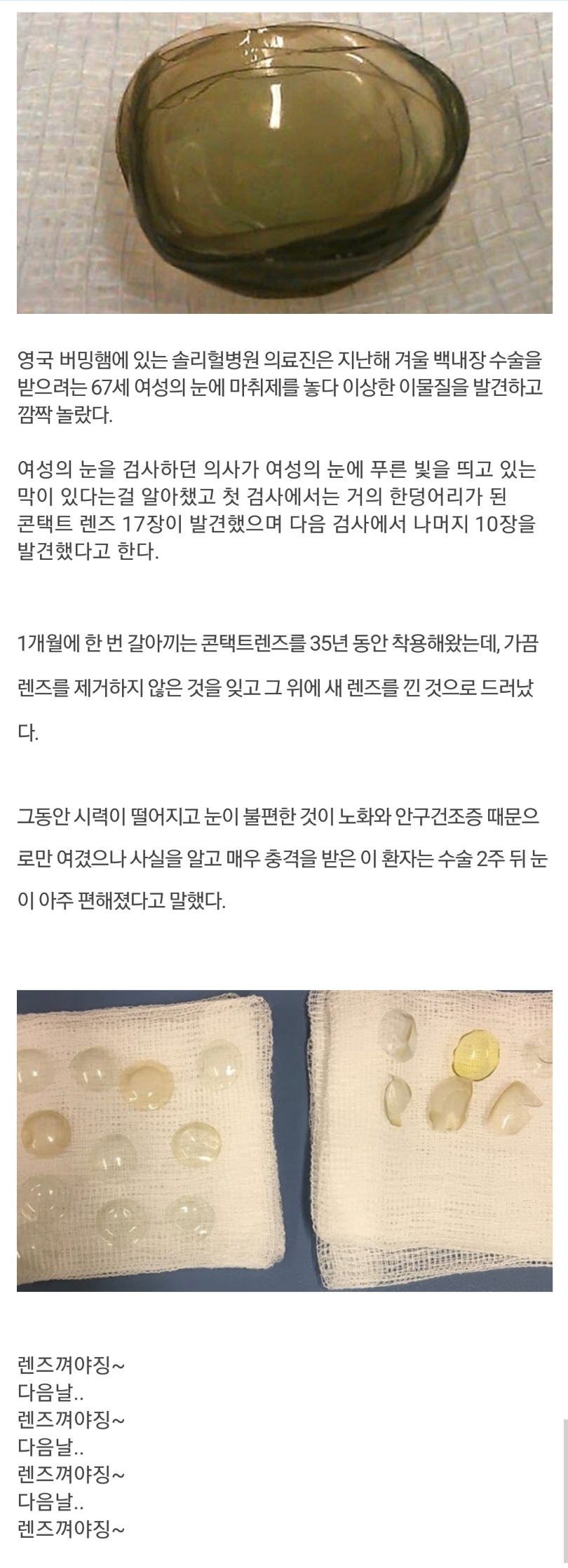 [유머] 67세 할머니 눈 속에서 나온 것 -  와이드섬