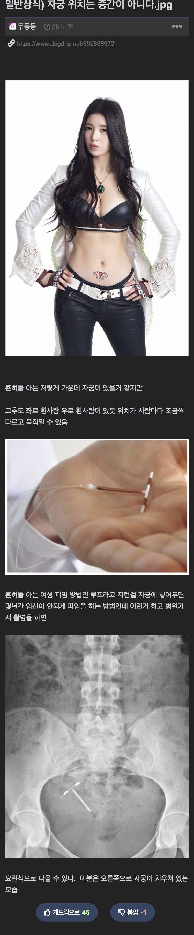 [유머] 일반인들이 잘 모르는 자궁의 실제 위치 -  와이드섬