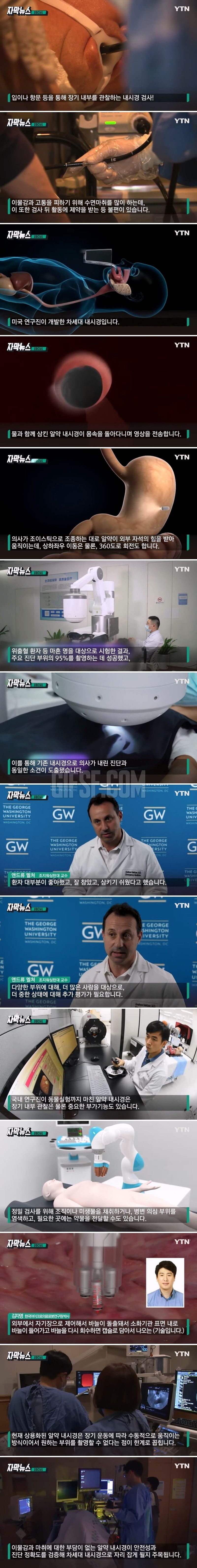 [유머] 불편했던 내시경 신기술 -  와이드섬