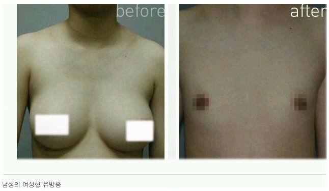 [유머] 의사를 당황시킨 여유증 환자 -  와이드섬