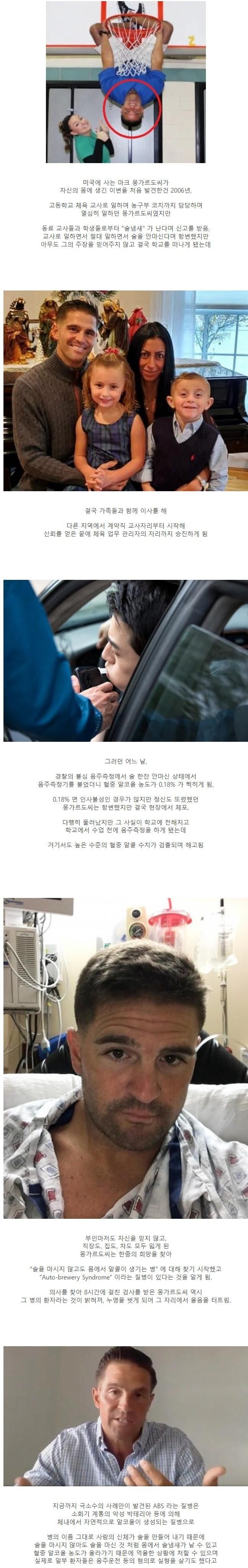 [유머] 희귀병 ABS를 아시나요? -  와이드섬