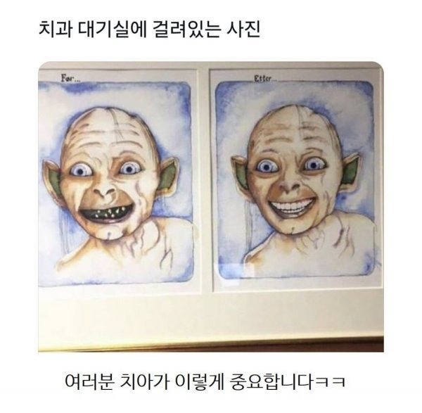 [유머] 치과 대기실에 걸려있는 사진 -  와이드섬