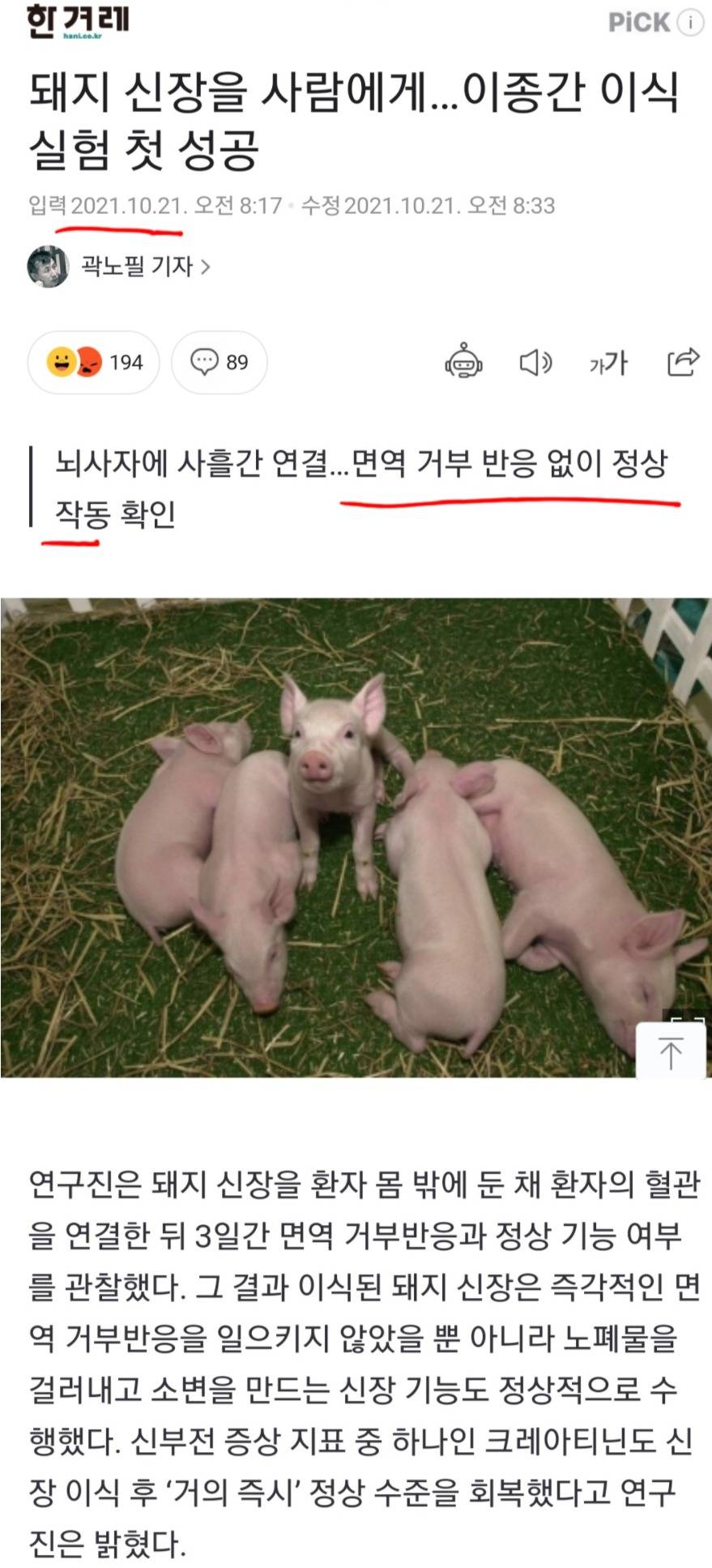 [유머] 이종간 장기이식 성공 -  와이드섬