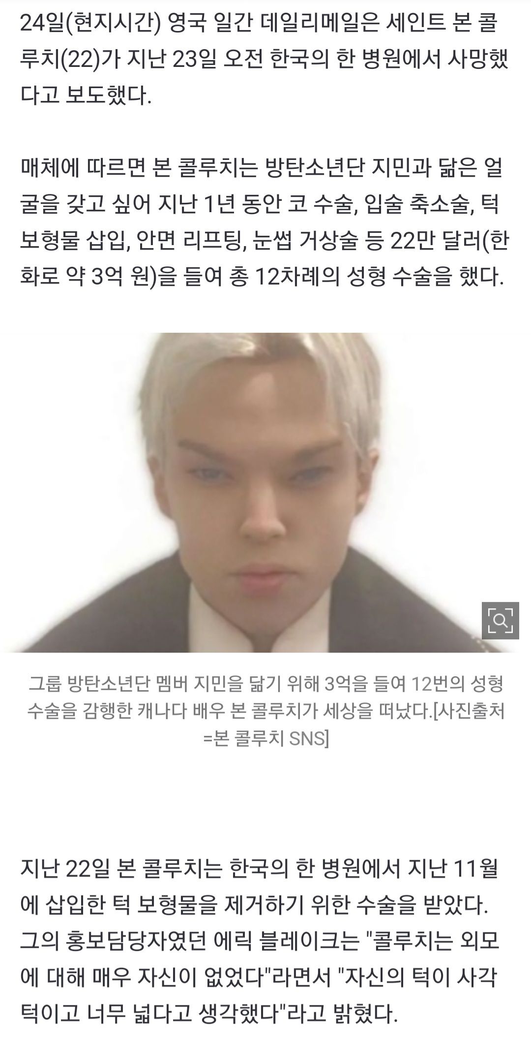 [유머] BTS 닮고 싶어 성형수술 12번 한 남자 -  와이드섬